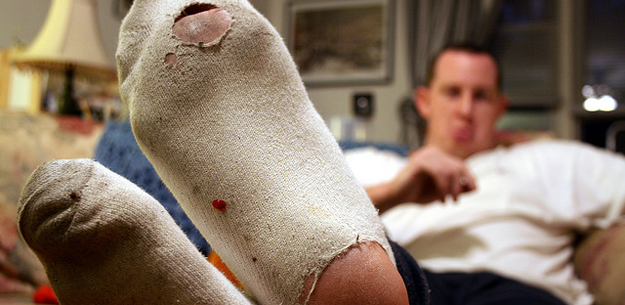 4 Foot-Health Hazards to Avoid